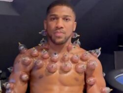 Anthony Joshua Lakukan Bekam, Pengobatan Warisan Nabi Muhammad